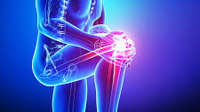 Orthopedic Surgery and Physical Therapy in Mexico